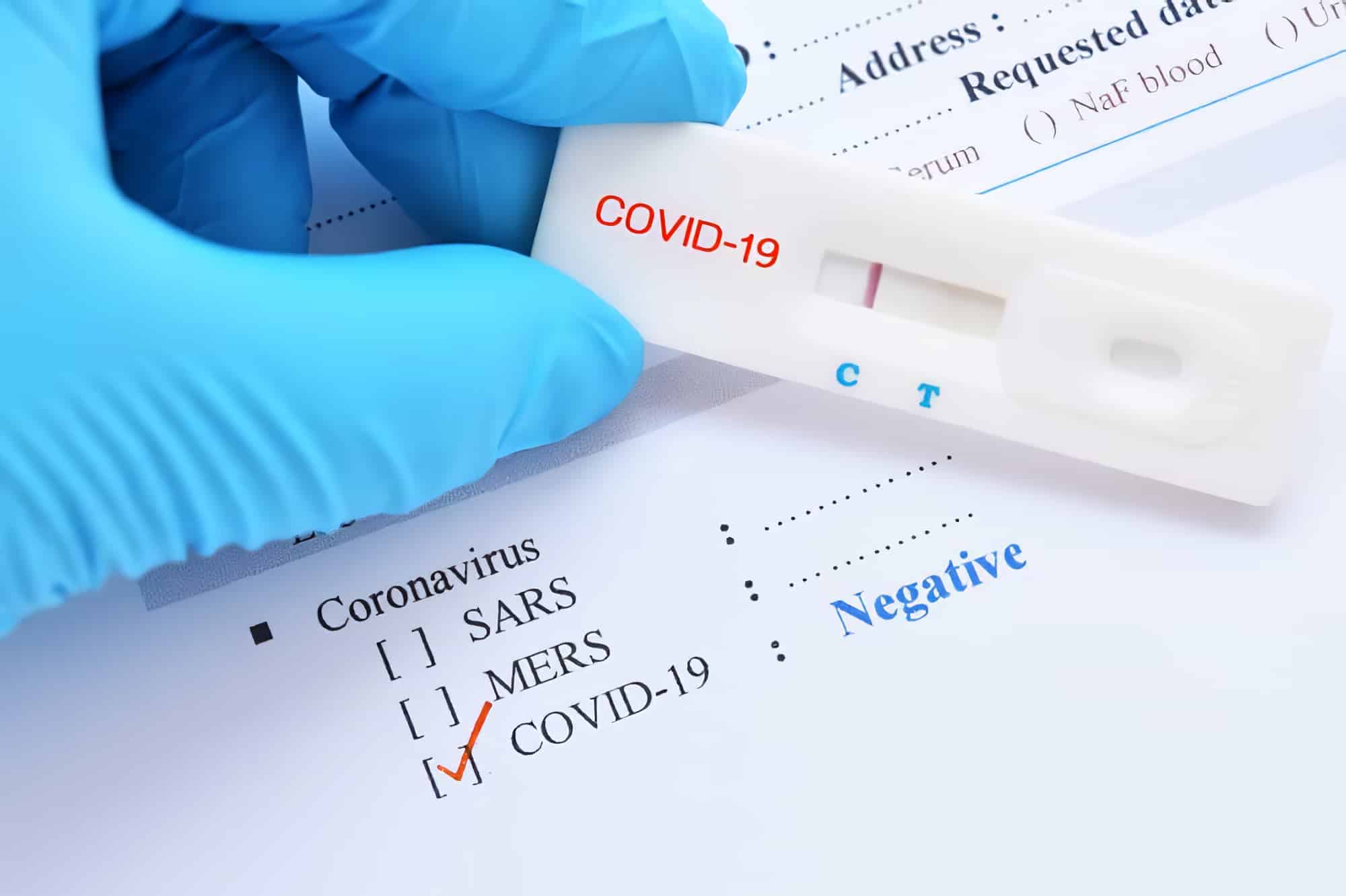 Voyage et COVID-19 : le test PCR est-il obligatoire ?